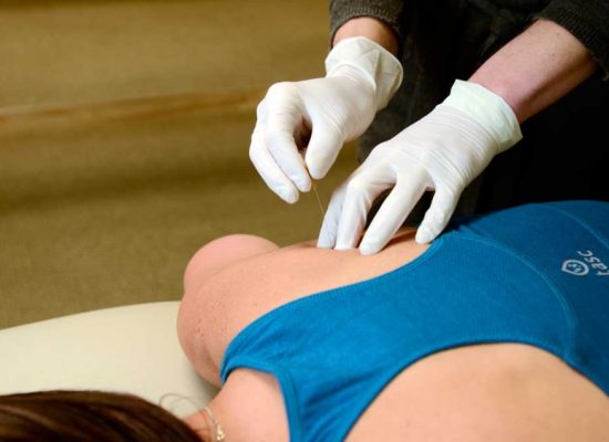 <span class="dojodigital_toggle_title">dry-needling-960×636-550×400</span>