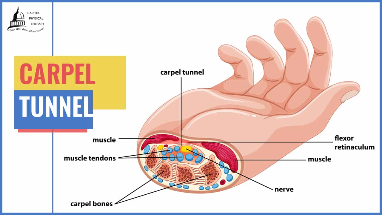 Physical Therapy Treatments For Carpal Tunnel Syndrome | Capitol Physical Therapy Washington DC | Pain & Injury Management