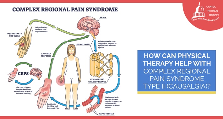 How Can Physical Therapy Help With Complex Regional Pain Syndrome Type II (Causalgia)? | Capitol Physical Therapy | Washington DC Physical Therapists