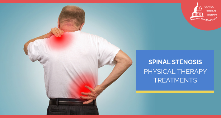 Spinal Stenosis Physical Therapy Treatments | Capitol Physical Therapy | Washington DC Physical Therapists