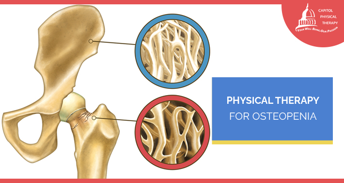 Physical Therapy For Osteopenia | Capitol Physical Therapy | Washington DC Physical Therapists