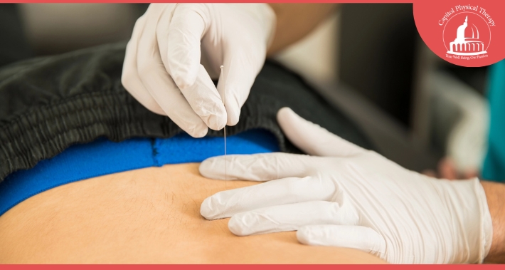 How Can Physical Therapy Help With Hip Bursitis? Pain Management | Capitol Physical Therapy | Washington DC Physical Therapists