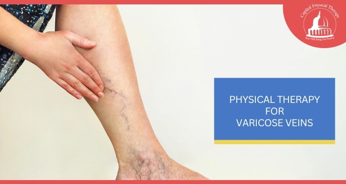 Physical Therapy For Varicose Veins | Capitol Physical Therapy | Washington DC Physical Therapists
