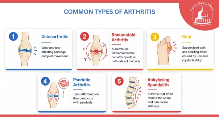 Infographic showing common types of arthritis, including osteoarthritis, rheumatoid arthritis, gout, psoriatic arthritis, and ankylosing spondylitis | Capitol Physical Therapy | Washington DC Physical Therapists
