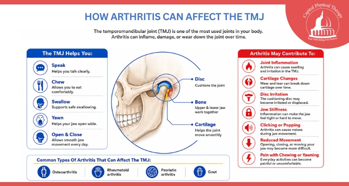 Infographic showing how arthritis can affect the temporomandibular joint and contribute to jaw pain, stiffness, clicking, and reduced movement | Capitol Physical Therapy | Washington DC Physical Therapists